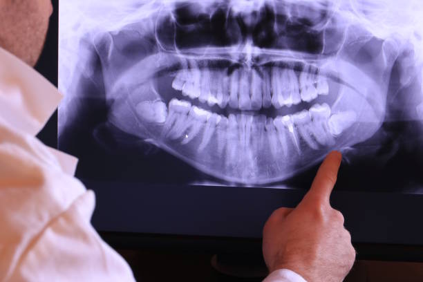Best Emergency Dental Filling Replacement  in Mount Airy, NC