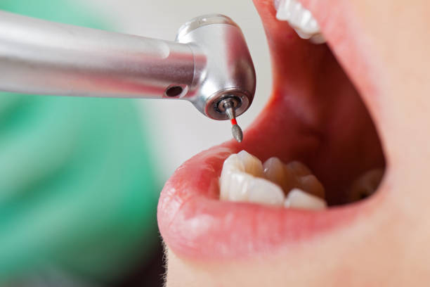 Best Urgent Tooth Repair  in Mount Airy, NC